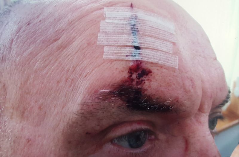 Other image for 70th birthday ruined after assault